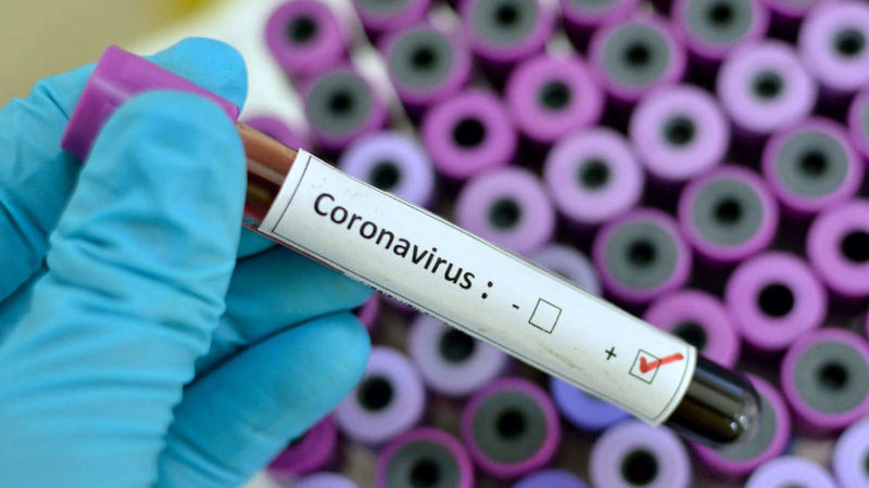 Studio dell’Università del Maryland: sarà il caldo a liberarci dal Coronavirus