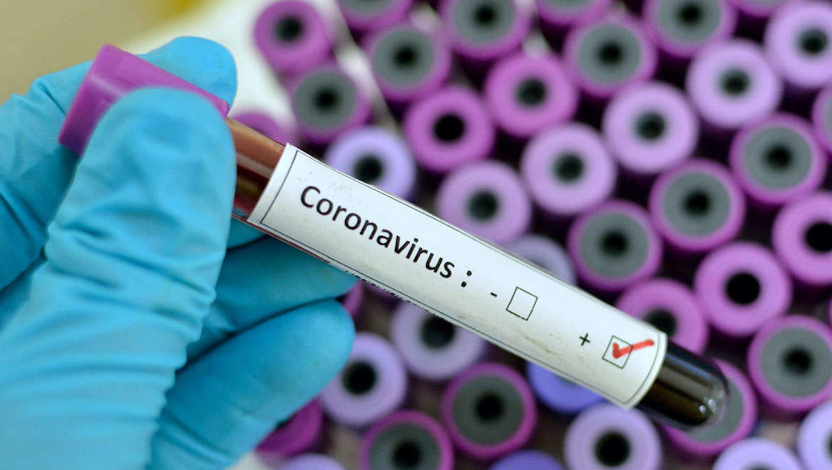 Studio dell’Università del Maryland: sarà il caldo a liberarci dal Coronavirus